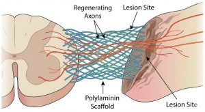 O que é polilaminina
